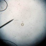Einzelliger Fischparasit: Trichodina