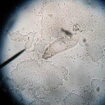 Fischparasit: Hautwurm Gyrodactlylus